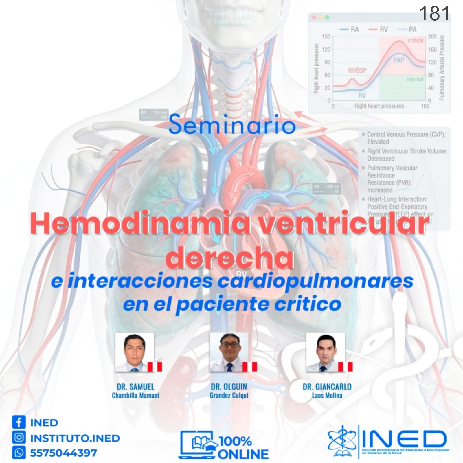 HEMODINAMIA VENTRICULAR DERECHA E INTERACCIONES CARDIOPULMONARES EN EL PACIENTE CRITICO