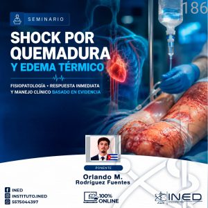 SHOCK POR QUEMADURA Y EDEMA TERMICO